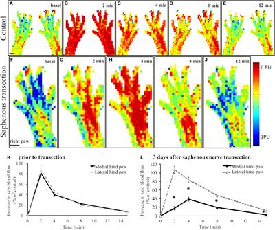 Longitudinal Study of Functional Reinnervation of the Denervated Skin by Collateral Sprouting of Peptidergic Nociceptive Nerves Utilizing Laser Doppler Imaging